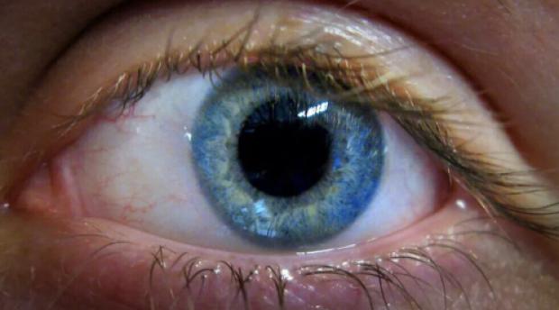 تشخیص زودهنگام یک بیماری خطرناک با نگاه به چشم کشف شد